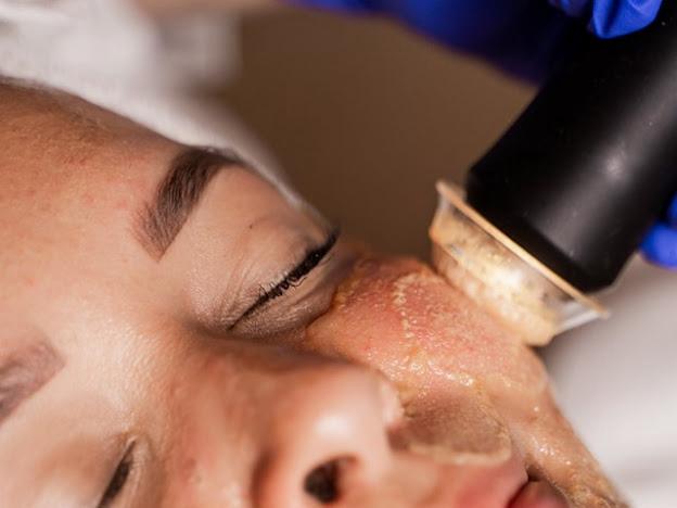 oxygeneo_behandeling_bloemendaal_overveen